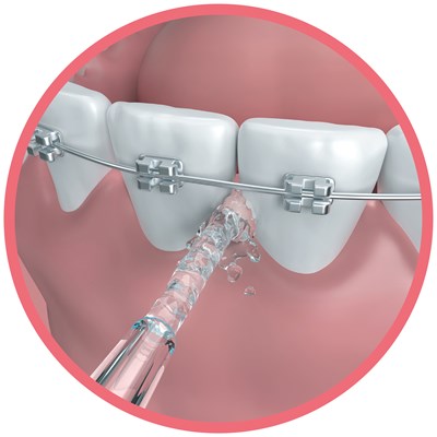 Go2 Dentagenie Water Flosser