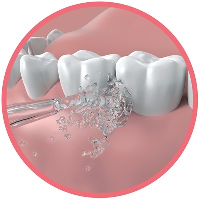 Go2 Dentagenie Water Flosser